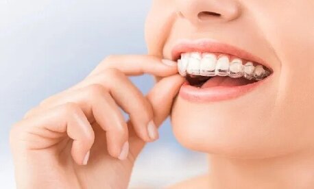 Singapore, Dental, The Benefits Of Invisalign Clear Aligners For Orthodontic Treatment