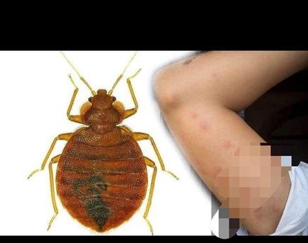 Riyadh, Pest Control, Carpet& Sofa Clean Pest Control Service @ Best Price