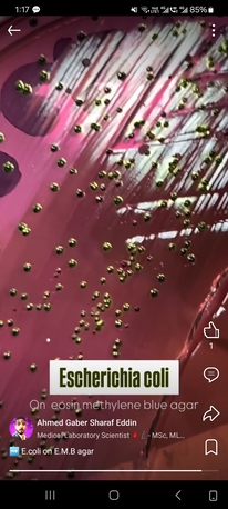 Riyadh, Job Seekers, Quality Control Microbiologist