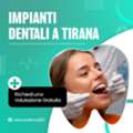IMPIANTI DENTALI A TIRANA &ndash; Sorridi Di Nuovo Con Fiducia!