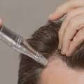 Professionele PRP Behandeling Haar Rotterdam Voor Optimale Haargroei