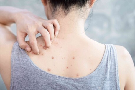 Singapore, Business, Bacne Treatment In Singapore | Clear Your Skin With Expert Care At Amber Beila