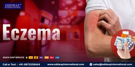 London, Wholesale Products, Best Anti Eczema Cream | Supplier & Wholesale | Oddway International