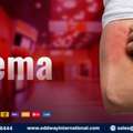 Best Anti Eczema Cream | Supplier & Wholesale | Oddway International