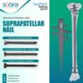 Advanced Fixation With Suprapatellar Tibial Nail