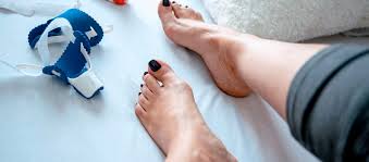 Singapore, Health, 5 Benefits Of Professional Bunion Care Services