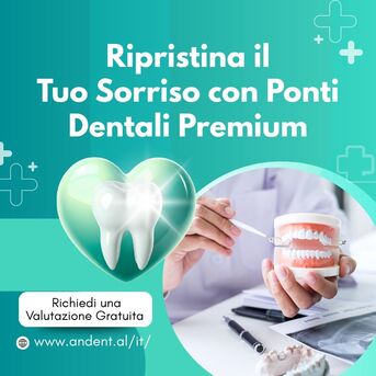 Milan, Dental, Ripristina Il Tuo Sorriso Con Ponti Dentali Premium