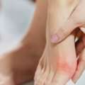 Best Foot Specialist In Singapore | Expert Foot Care & Podiatry Treatments