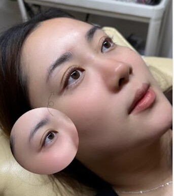 Singapore, Beautician, Best Service For Laser Hair Removal In Tampines