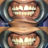 Kuala Lumpur, Dental, Kamii Dental Clinic Larkin Perdana JB