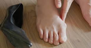 Singapore, Health, 5 Importance Of Minimally Invasive Bunion Surgery