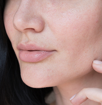 Singapore, Fashion & Design, Botox Treatment Singapore For Smooth Youthful Skin | Radium Medical Aesthetics