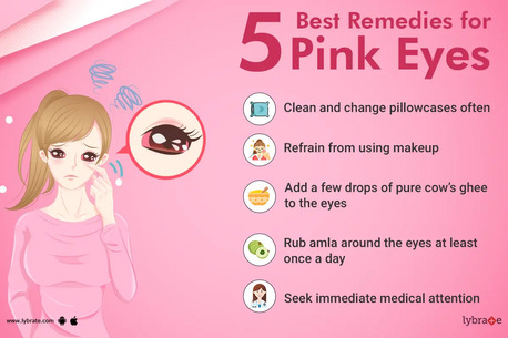 Dubai, General, Natural Remedies For Pink Eye: Gentle Home Relief Options