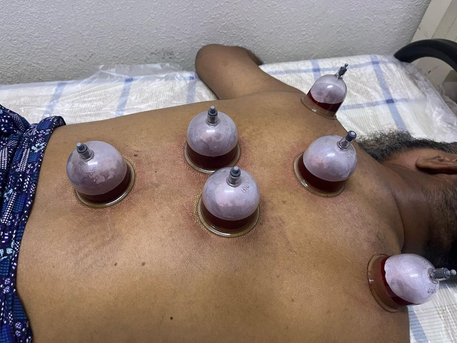 Dammam, Furniture, SAR 120,  Hijama - Home Service