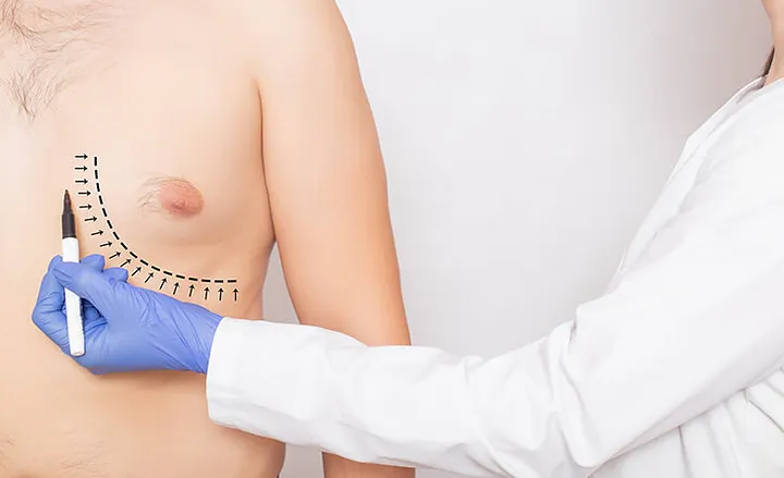 Mumbai, Health, Cosmetic Surgery For Men: What&rsquo;s Trending Right Now