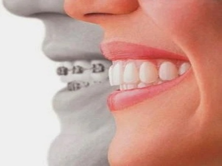 New York, Dental, Fremont Star Dental - Dental Implants, Orthodontics | Dr. Uma Patel DDS