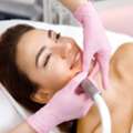 Acne Scars Treatment In Dubai For Clearer, Smoother, Confident Skin