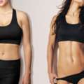 RG SHARP Technique For High-Definition Abdominoplasty