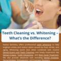 USD 199,  Teeth Cleaning Vs. Whitening &ndash; What&rsquo;s The Difference?