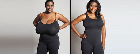 Mumbai, Health, Flap Technique Surgery: Innovative Breast Reduction Surgery