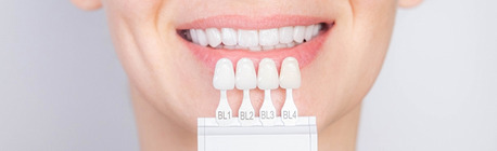 Washington DC, Dental, What Are Dental Veneers Procedure?
