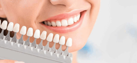 Washington DC, Dental, What Are Dental Veneers Procedure?