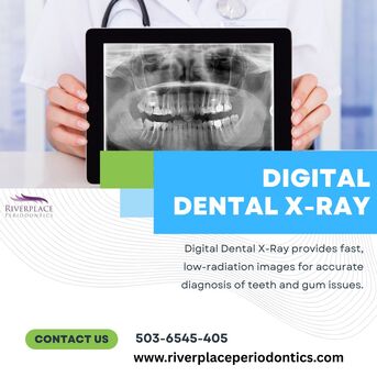 Los Angeles, Dental, Professional Digital X-Ray Services For Teeth Examination
