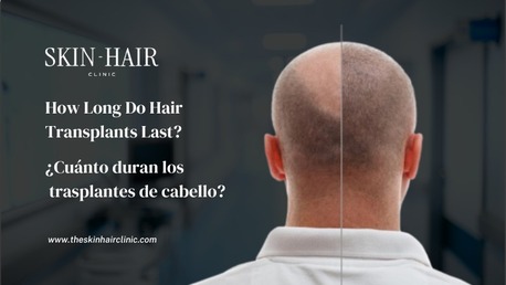 Cali, Health, Hair Restoration Clinic Medell?n