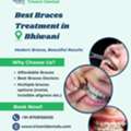Best Braces Treatment In Bhiwani | Triveni Dental