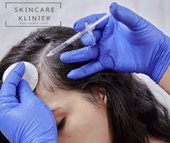 Rotterdam, Health, Versterk Je Haargroei Met Haargroeibehandeling Voor Mannen Rotterdam