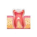 Quick And Comfortable Root Canal Treatment Services