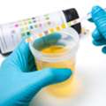 Pathology Laboratory In Ahmedabad