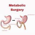 Advanced Metabolic Surgery Care In Ahmedabad