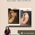 Keloids Causes And Treatment - Derma One Vizag
