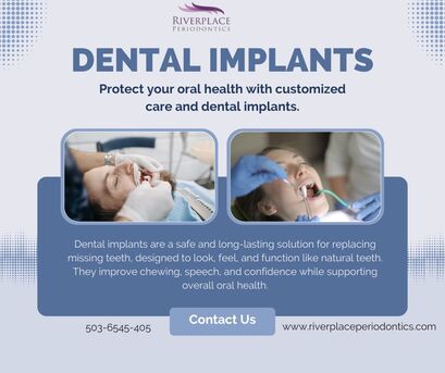 Los Angeles, Health, Dental Implant Safety Explained For Patients