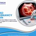 Advanced 3D And 4D Ultrasound In Indore For Fetal Care