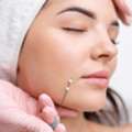 Facial Thread Lifting In Bengaluru Near Me | ZIUR Wellness
