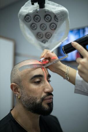 Ahmedabad, Health, Clion Care &ndash; Expert Hair Transplant & Restoration Clinic