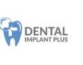 Dental Implant Plus