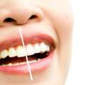 Brighten Your Smile And Confidence With Teeth Whitening