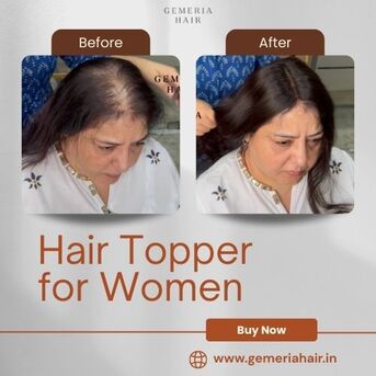 Noida, Clothing & Accessories, Hair Topper For Women: Natural Coverage For Crown Thinning & Bald Spots