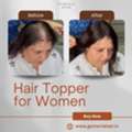 Hair Topper For Women: Natural Coverage For Crown Thinning & Bald Spots
