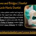 USD 199,  Dental Crowns And Bridges | Dentist In Arizona Kevin Harris Dentist.