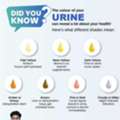 Don&rsquo;t Ignore Urine Colour Changes | Best Urologist In Bhubaneswar | Dr. Shiva Prasad Sahoo