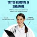 Professional Tattoo Removal Singapore &ndash; Safe, Effective & Affordable