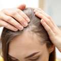 Looking For Effective Hair Loss Treatment Clinic In Noida?