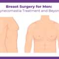 Gynecomastia Surgery In Pune