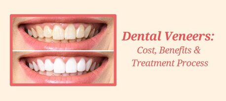 San Francisco, Health, Are Denture Veneers Painful?