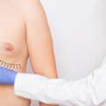 Gynecomastia Surgery