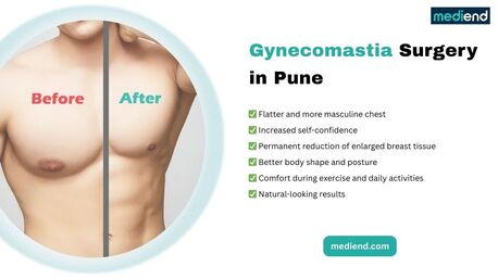 Pune, Health, Gynecomastia Surgery In Pune